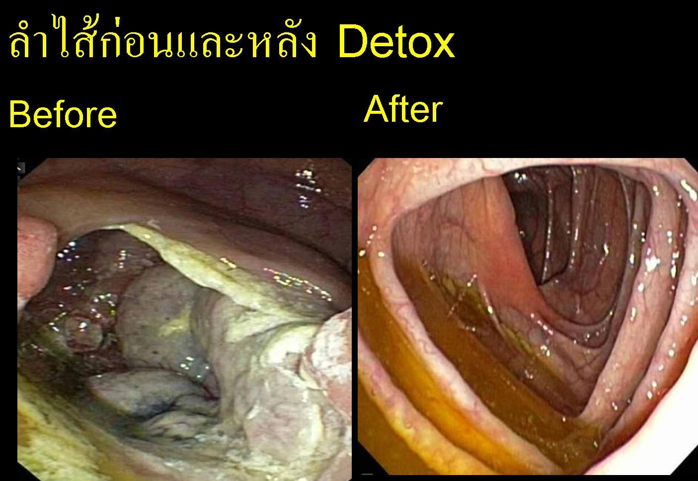 Expert Tips for a Safe and Effective Detox Journey